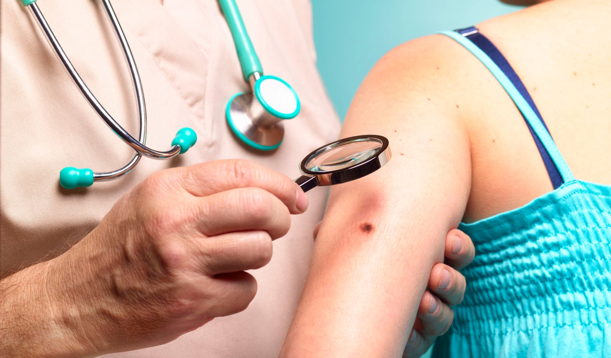 Doctors share early skin cancer symptoms you should be aware of