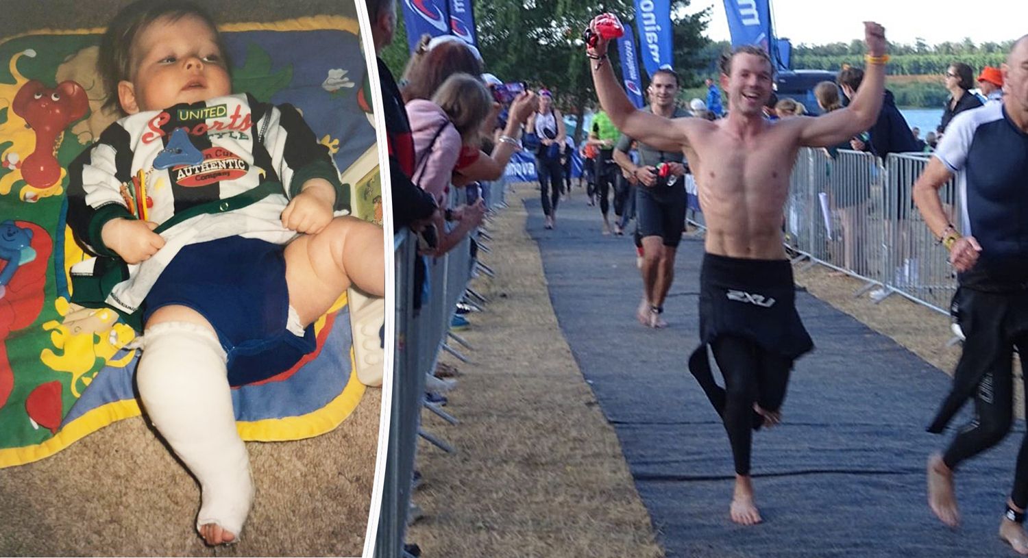 I was born with clubfoot and told I could never play high-impact sport - now I run triathlons