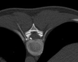 Henning Sommerfeld-15