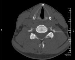 Henning Sommerfeld-13