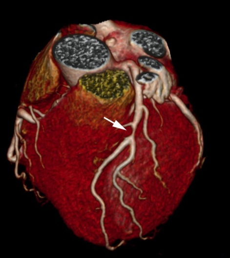 Henning Sommerfeld-12