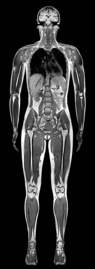 Henning Sommerfeld-10