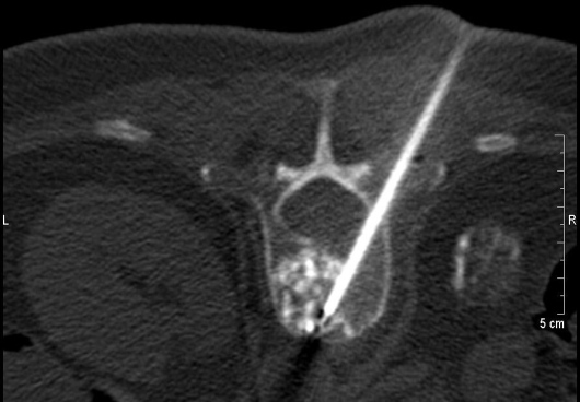 Henning Sommerfeld-16