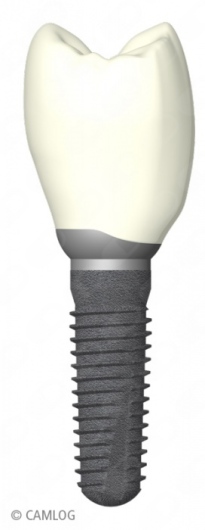 Leopold Fleischmann-5