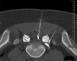 Henning Sommerfeld-14