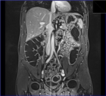 Henning Sommerfeld-11