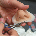 Medical Prosthetics