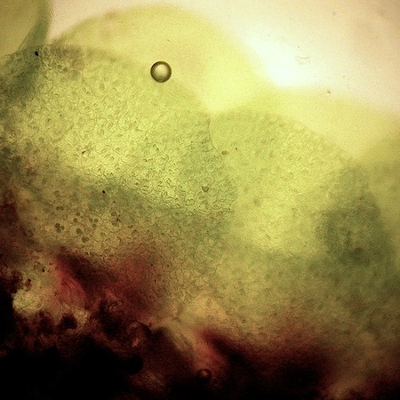 Jungermannia hyalina