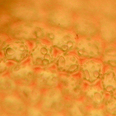 Odontoschisma elongatum