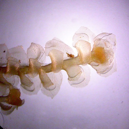 scapania irrigua