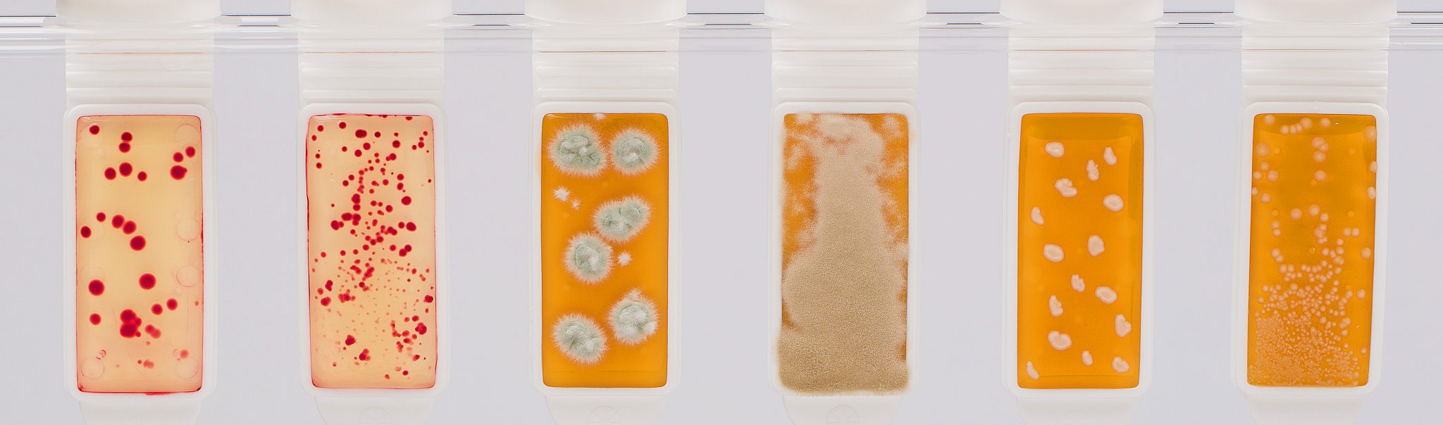 Dip Slides ECHA Microbiology