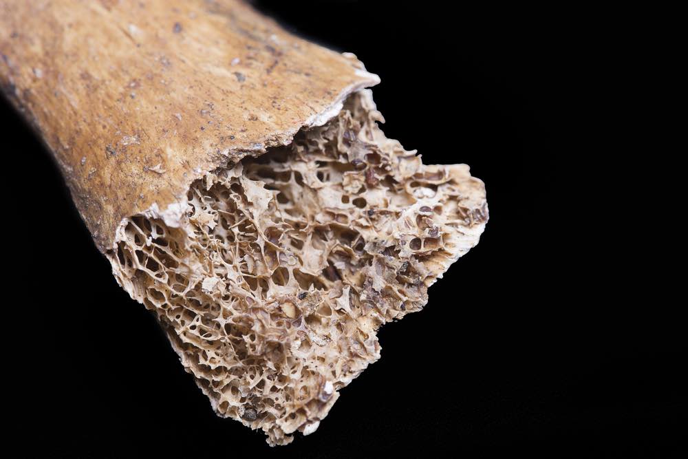 9 Reasons Why You Should Stop Drinking Milk