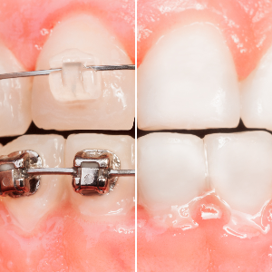 Calidad de servicio-Smile Line