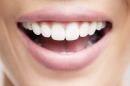 Dentist Denteffect