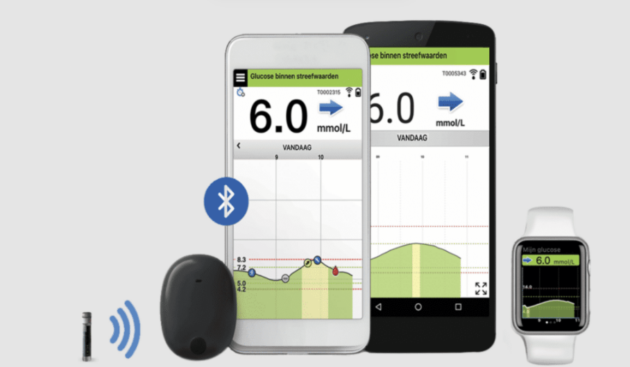 Implanteerbare Sensor