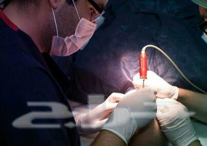 زراعة الشعر في تركيا اسطنبول او أنقرة