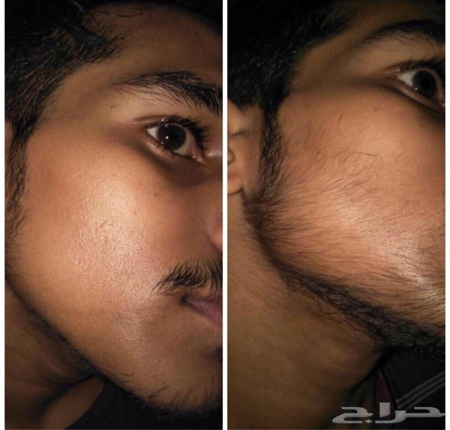 افضل زيت لاطالة الدقن والفرغات