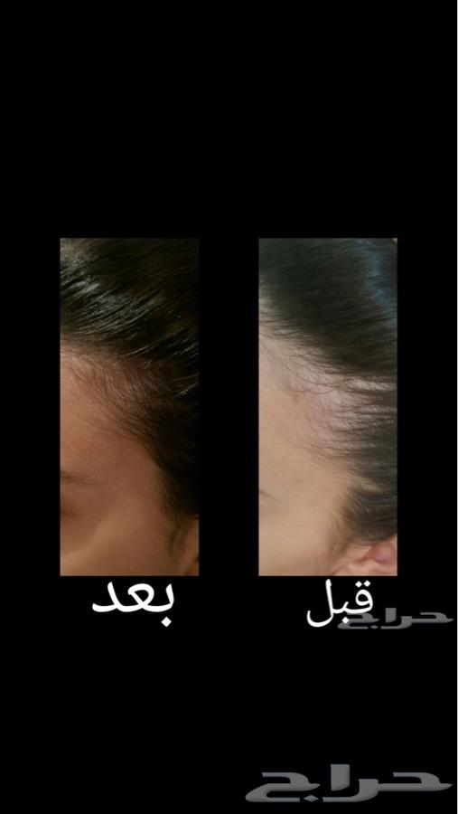 زيت الشعر الافغاني خام وأصلي 100في100