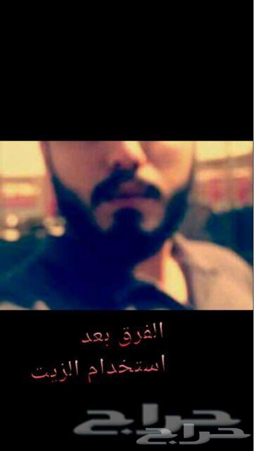 تعاني تساقط الشعر او فرغات الذقن و الصلع