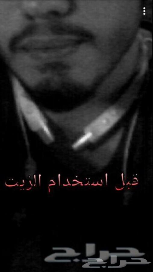 تعاني تساقط الشعر او فرغات الذقن و الصلع