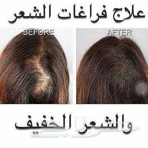 نظرا لطلبكم مددنا العررض يومين الزيت الافغاني