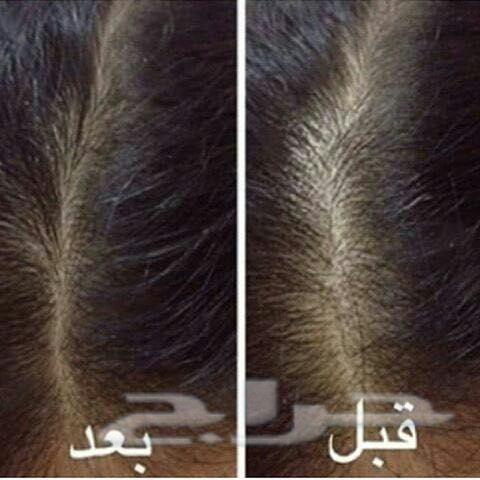 نظرا لطلبكم مددنا العررض يومين الزيت الافغاني