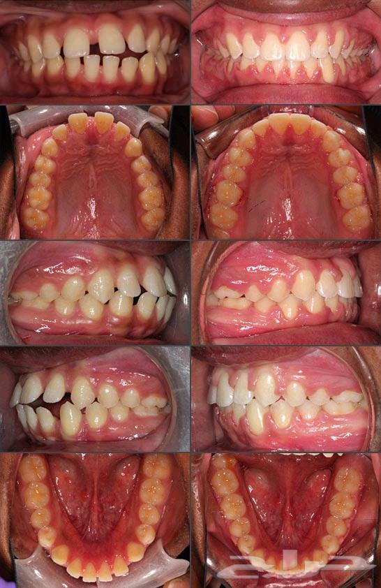 تقويم الاسنان الطبي بارخص الاسعار
