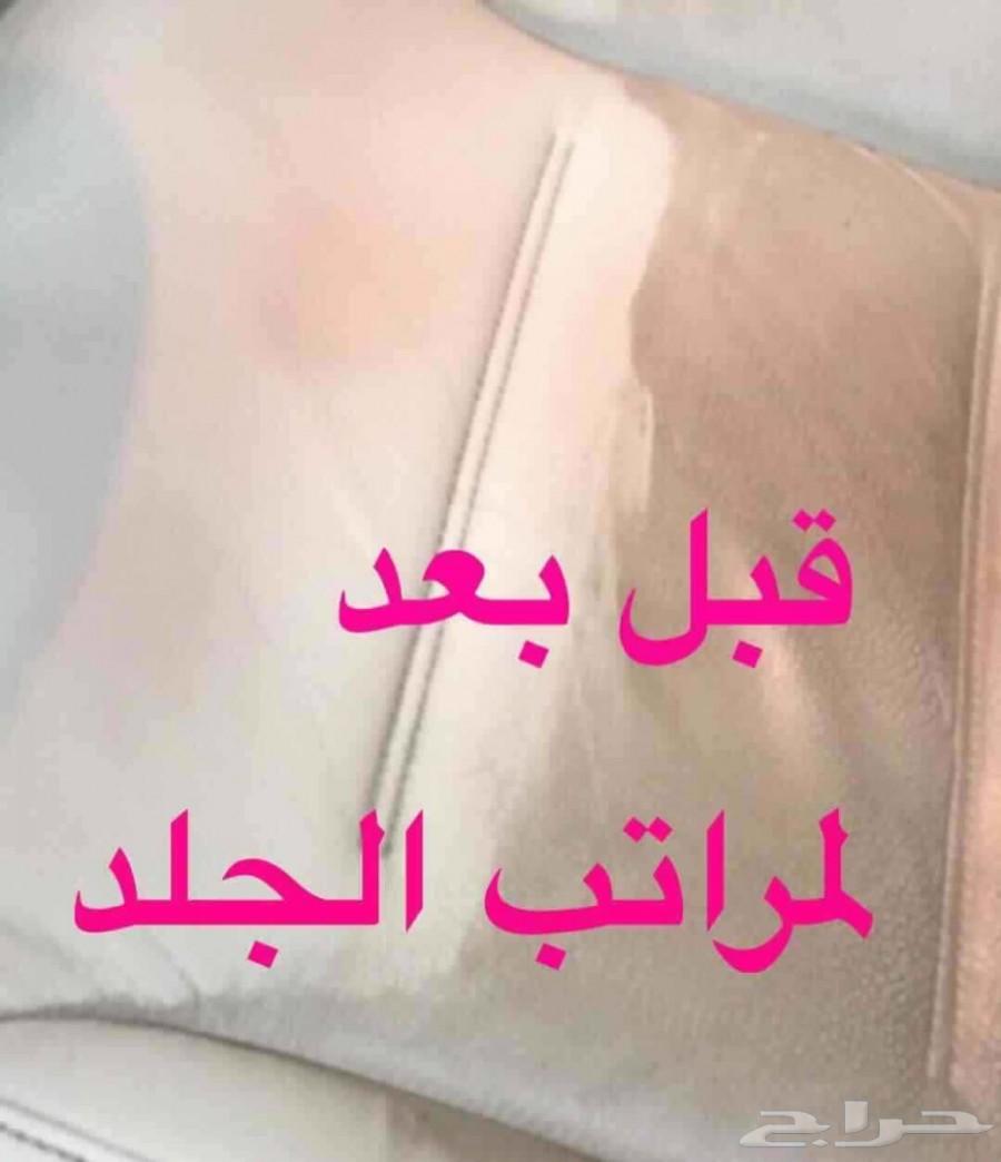قاهر البقع XO2