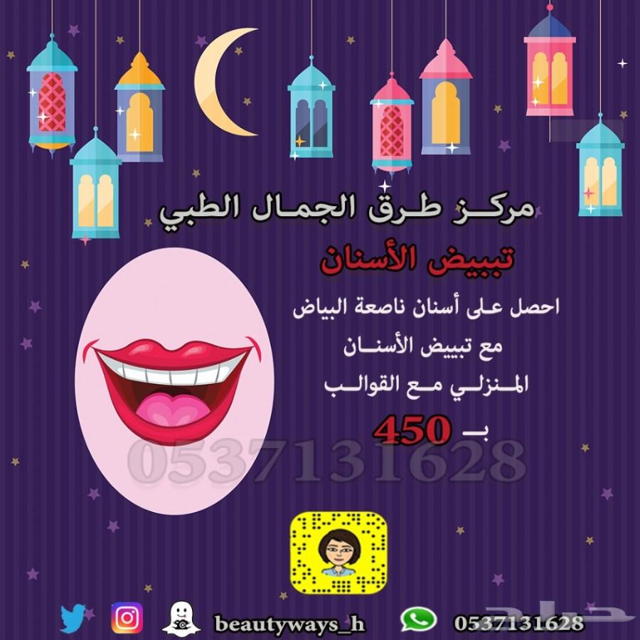 عرض على تبييض وتنظيف الاسنان-مركزطرق الجمال