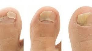 Margherita Fadda Blattner-10