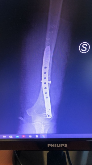 Francesco Tancredi-14