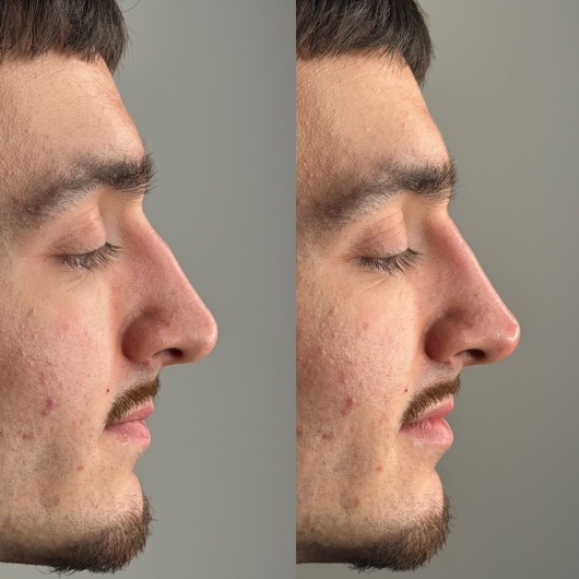 Alberto Di Bartolomeo-0