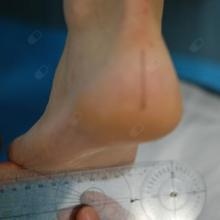 Ingrandire l'immagine: Fabio Alberzoni, podologo Milano