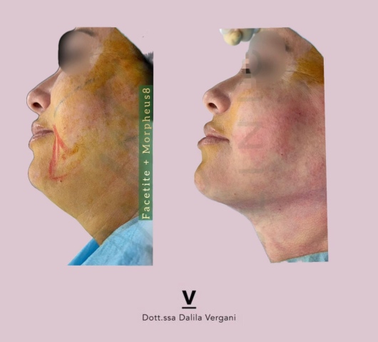 Dalila Vergani-47