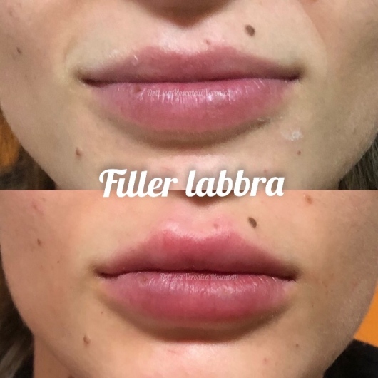 Veronica Moscatelli-2