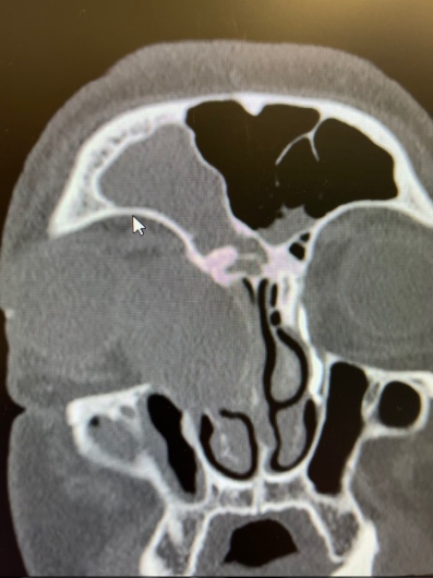 Giorgio Oliviero Gallone-17