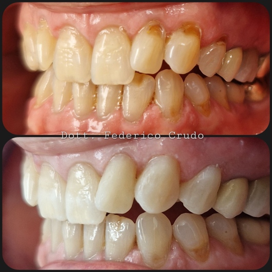 Federico Crudo-3