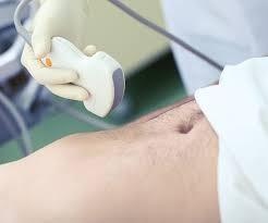 Nicolangelo Rossini-0