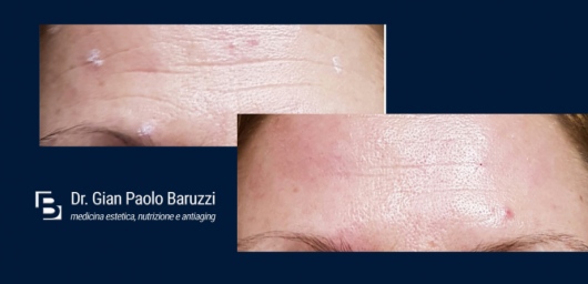 Gian Paolo Baruzzi-1