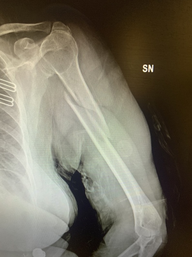 Francesco Tancredi-8