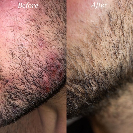 Piergiorgio Turco-28