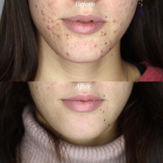 Piergiorgio Turco-30