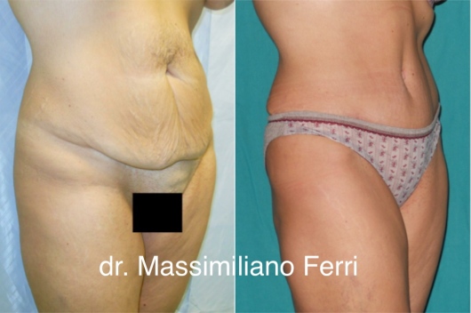 Massimiliano Ferri-4