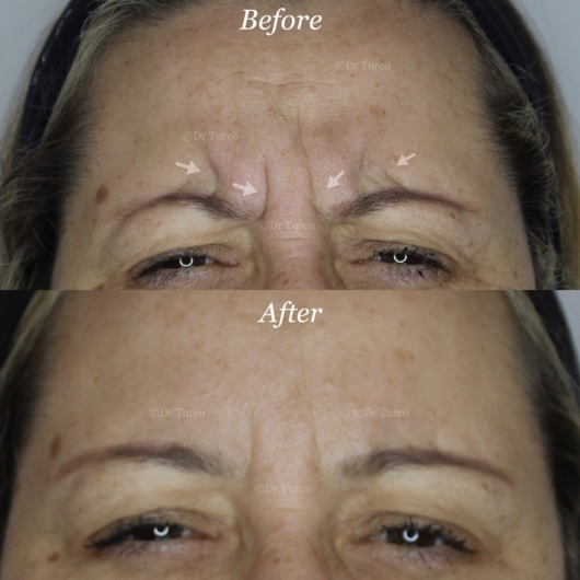 Piergiorgio Turco-13