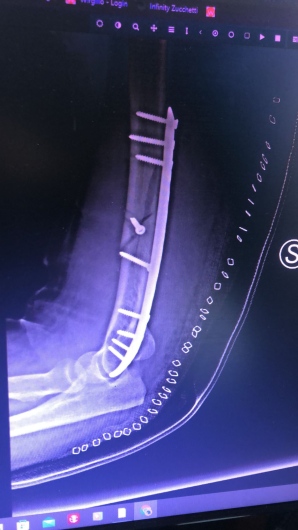 Francesco Tancredi-15