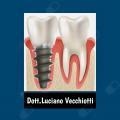Luciano Vecchiotti, dentista Roma