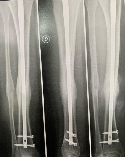 Francesco Tancredi-17