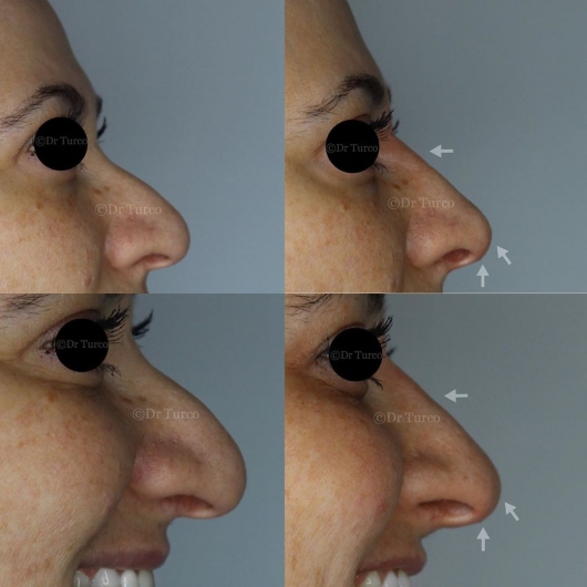 Piergiorgio Turco-10