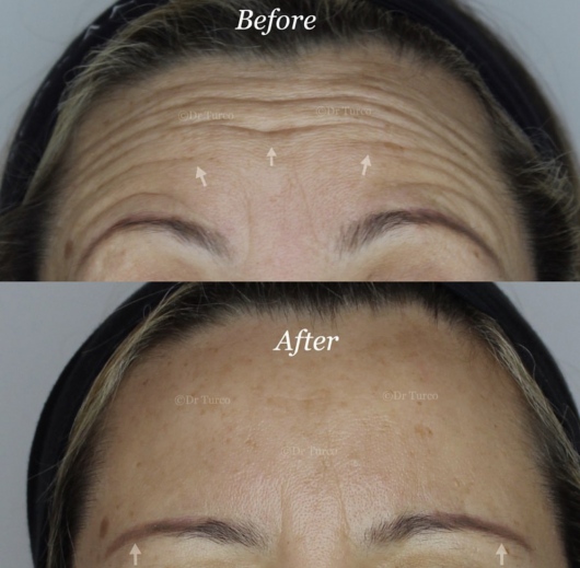 Piergiorgio Turco-12