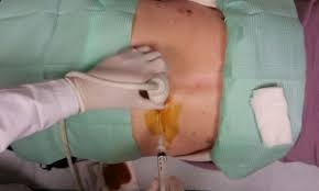 Alessandro Calafiore-6